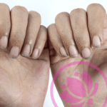 uñas descuidadas, uñas sucias, feas, cortas y manos de mujer